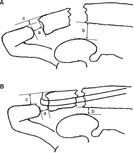 jkfs-27-127-g002.jpg