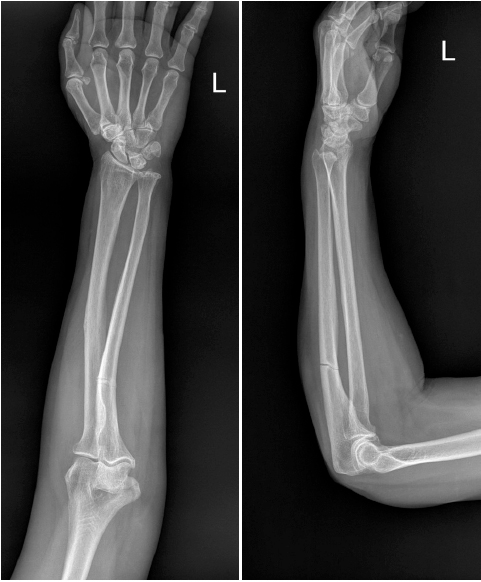 Fig. 4
