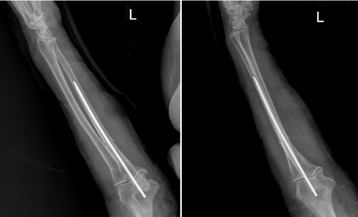 Fig. 5