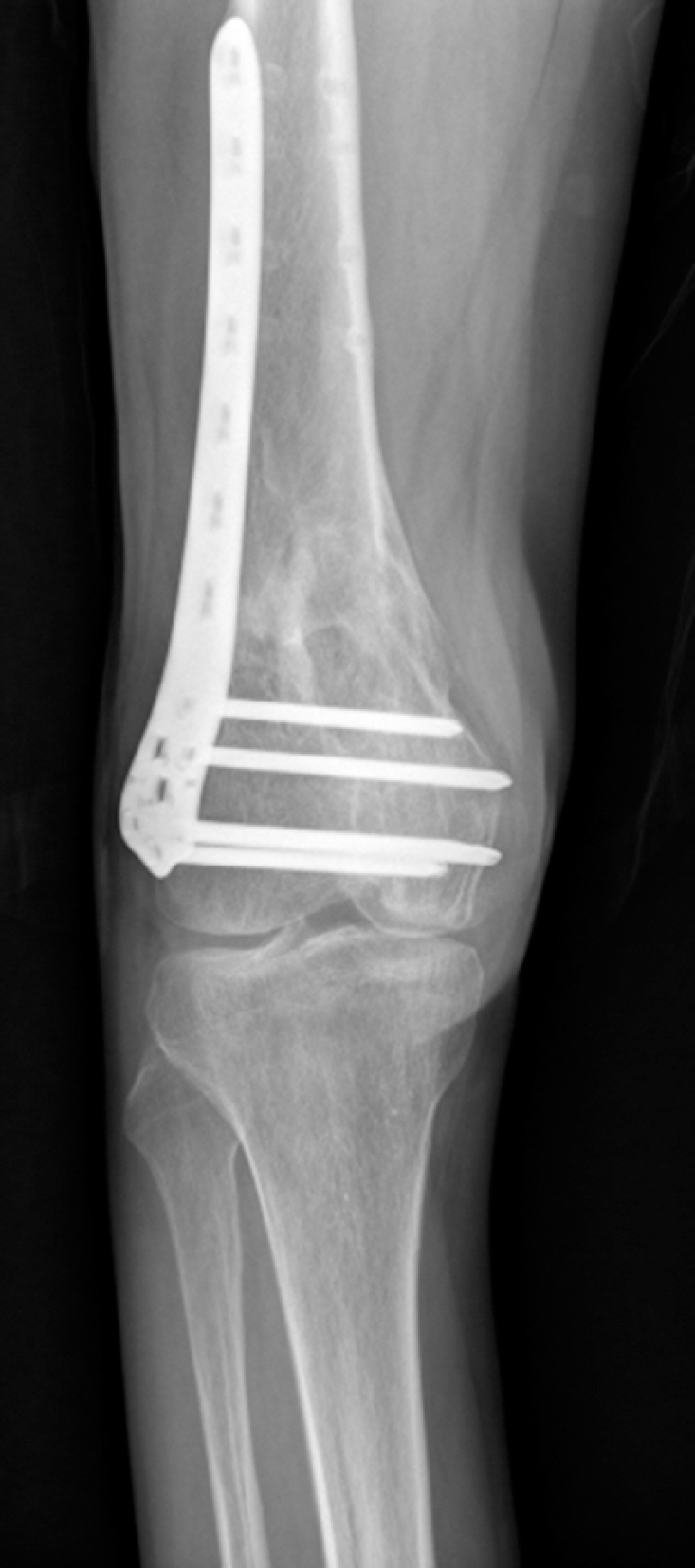 Fig. 6.