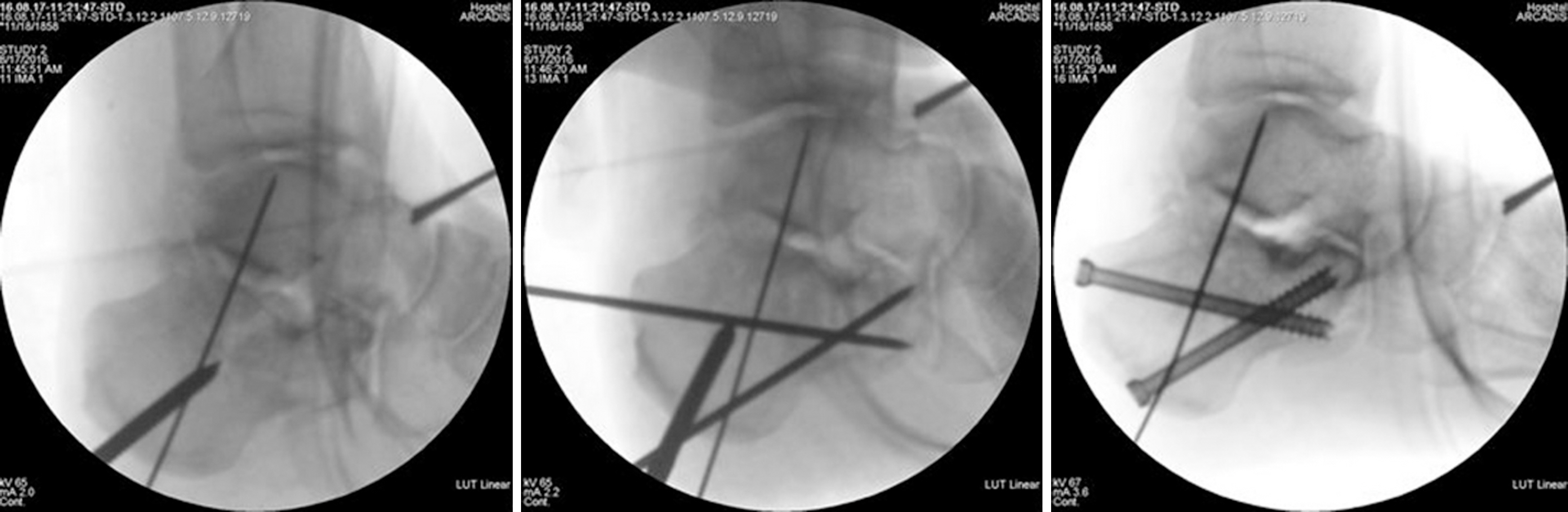 Fig. 3.